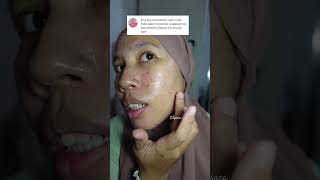 Effaclar duo plus bisa dicombo sama cicaplast yaaa gaes aman ✌🏻 larocheposay jerawat [upl. by Sculley289]