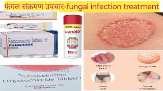 fungal infection treatment in Hindi  causes  Hindi  health  PharmacistHindi [upl. by Anitirhc]