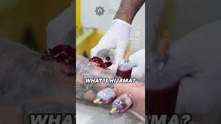 WHAT IS HIJAMA EXPLAINED [upl. by Bunni464]