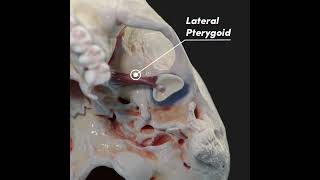 Temporomandibular joint TMJ and its articular disc [upl. by Mcclelland]