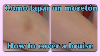 Como cubrir un moretón ♡ How to cover a bruise [upl. by Aivull]