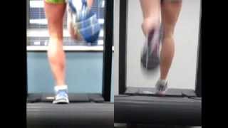 Shin Splint  Video Analysis RunSmart Online [upl. by Sergio]