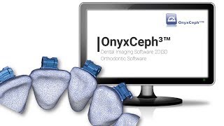 OnyxCeph³™ Overview 3D  2017 [upl. by Edward]