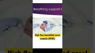 Baby on high flow humidified nasal cannula HFNC nicu neonatal neonatology ventilation HFNC [upl. by Atterbury]