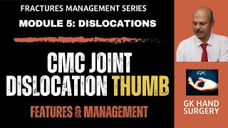 Thumb carpometacarpal joint dislocation CMC joint  Features and management [upl. by Mima]