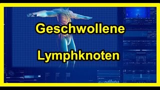 Geschwollene Lymphknoten  Vergrößerte Lymphknoten 2020 [upl. by Nivra]