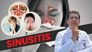 SINUSITIS CÚRELA CON MEDICINA NATURAL HOLISTICA [upl. by Toblat]