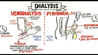 Failing Kidneys and Different Treatment Options [upl. by Arol]