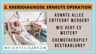 2 Krebsdiagnose War die erneute Operation erfolgreich Wie gehts weiter Chemo Bestrahlung [upl. by Ledairam]