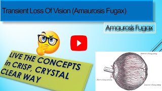 Transient Loss Of Vision Amaurosis Fugax [upl. by Eahc]