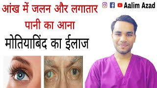 Best Eye Exercises To Improve Your Vision  Aalim Azad eyetreatment viralvideo cuppingtherapy yt [upl. by Arta444]