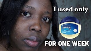 I used only VASELINE on my face everyday for 7 days and this is what happened [upl. by Daile173]