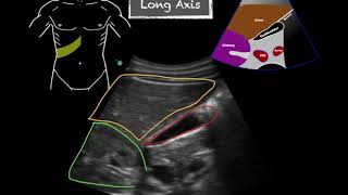 POCUS  Gallbladder Ultrasound Anatomy [upl. by Essilem544]