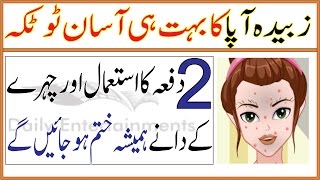 Chehre Face Ke Dano Ko Hamesha Khatam Karne Ka Zubaida Apa Ka Totka زبیدہ آپا کا بہت ہی آسان ٹوٹکہ [upl. by Soilissav]