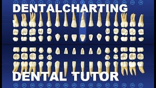 🦷 dentalstudents Charting review [upl. by Key]