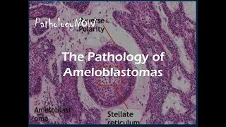 SKIN LESIONS PEMPHIGUS PART1 [upl. by Isahella992]