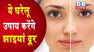 चेहरे की झाइयां दूर करने के आसान घरेलू उपाय Home Remedies for Bright Skin [upl. by Tore422]