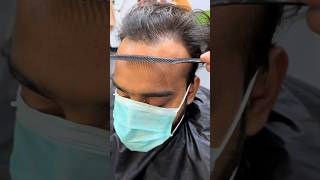 Hairline Receding Ka Natural Tareeka  Mridul Madhok [upl. by Dagnah128]