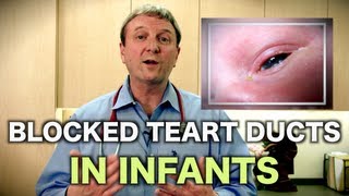 Blocked Tear Ducts in Infants Pediatric Advice [upl. by Avera]