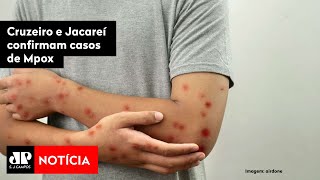 Cruzeiro e Jacareí confirmam casos de Mpox [upl. by Dnomzed993]