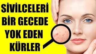 SİVİLCELERİ BİR GECEDE YOK EDEN KÜRLER [upl. by Steinman221]