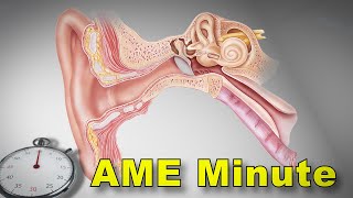 AME Minute Why did the FAA allow AMEs to issue pilots with BPPV [upl. by Adnuahsar]