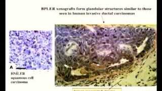 Cancer Stem Cells and Malignant Progression [upl. by Irami]