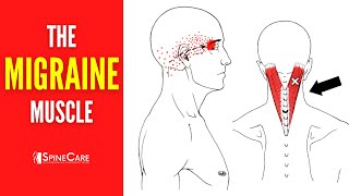 How to Release Tension for FAST MIGRAINE RELIEF [upl. by Clare422]