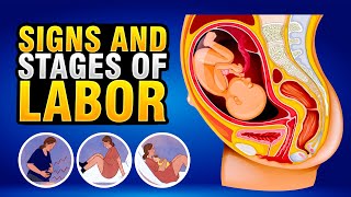 Pregnancy  SIGNS AND STAGES OF LABOR [upl. by Akiam]