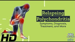 Relapsing Polychondritis Demystified From Symptoms to Solutions [upl. by Laval]