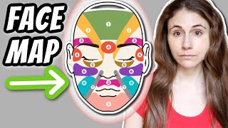 What can FACE MAPPING YOUR ACNE tell you  Dr Dray [upl. by Renba]