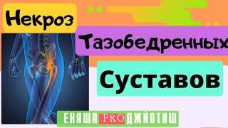 Проблема с Тазобедренными суставами Медицинская астрология [upl. by Enneirda]