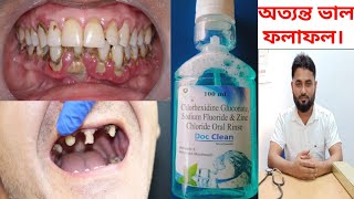 Doc Clean Mouthwash Chlorhexidine Gluconate Sodium Fluoride amp Zinc Chloride Oral Rinse [upl. by Adnomar103]