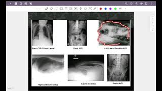 Abdominal radiograph part 1  How to approach to abdominal xray amp pneumoperitoneum [upl. by Hara917]