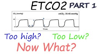 Capnography Waveform Interpretation Etco2 basics explained [upl. by Kimbra]