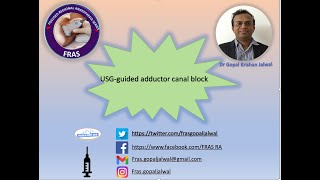 USG Guided Adductor canal block [upl. by Ambrosio]