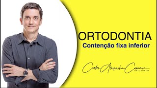 Contenção ortodôntica inferior [upl. by Emylee]