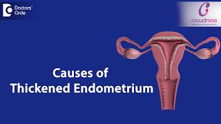 What causes Endometrial thickness  DrSmitha Sha of Cloudnine Hospitals  Doctors Circle [upl. by Nathaniel]