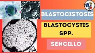 BLASTOCISTOSIS  BLASTOCYSTIS SPP POSIBLE CAUSA DEL INTESTINO IRRITABLE [upl. by Nihahs179]