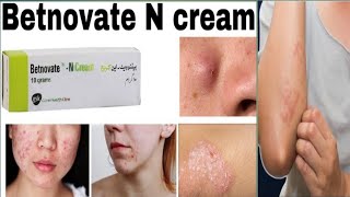 betnovate cream  betnovate n skin cream  betnovate c cream  betnovate c skin cream uses in Urdu [upl. by Meilen251]