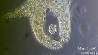 Amoeba eats paramecia  Amoebas lunch   Amoeba Endocytosis  Phagocytosis Part 1  👌 [upl. by Tiffi143]