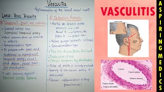 Vasculitis pathology lecture part 1Temporal giant cell and takayasus arteritis Aspiring medics [upl. by Seuguh]