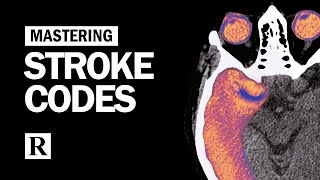 Mastering Stroke Codes [upl. by Enomad]