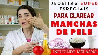 Acabe com as MANCHAS NA PELE inclusive MELASMA  Receita Caseira [upl. by Ardith]