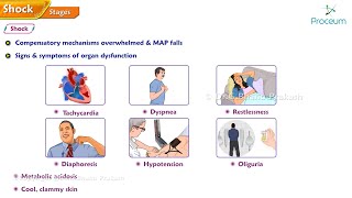 3Shock Stages of Shock Diagnosis [upl. by Schapira]