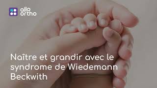 Naître et grandir avec le syndrome de Wiedemann Beckwith [upl. by Nylia]