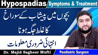 Hypospadias CausesSymptoms And Treatment In Urdu [upl. by Eerb]