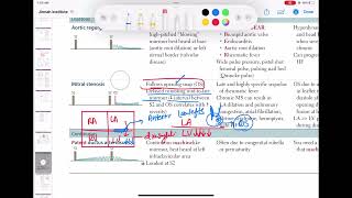 Mitral stenosis Murmur cardiology 40  First Aid USMLE Step 1 in UrduHindi [upl. by Martell726]