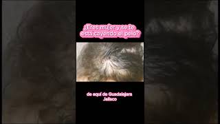 Caida de cabello en Mujeres  Alopecia en Mujeres [upl. by Gerhardine800]