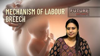 MECHANISM OF LABOURBREECH PRESENTATIONDHANYA DEEPUOBGHIGH RISK LABOUR [upl. by Reddin575]